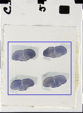 Media type: image; Special Collections 3298   shows specimen_part histological serial section;
